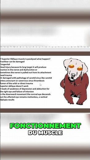 Diplopie Verticale: Causes et Solutions pour la Vision