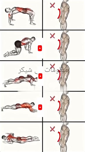 Treatment for lower back kyphosis at home.#علاج قعس أسفل الظهر في البيت 🏠