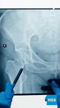 Pelvic Health and Rehabilitation Explained | HSS