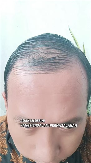 𝐁𝐈𝐎-𝐄𝐒𝐒𝐄𝐍𝐂𝐄 100% 𝐁𝐀𝐓𝐀𝐍𝐀 𝐎𝐈𝐋 #bioessence #batanaoil #serumrambut #fyp #fypage