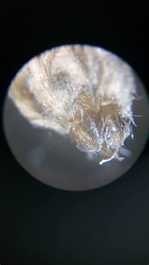 Spider under a microscope #microscope #science #biology #spider #imback