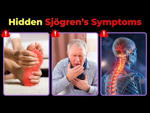 Senior? Hidden Primary and Secondary Sjögren’s Symptoms You Must Know Now!