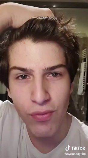 Transformative Mewing Before and After Results