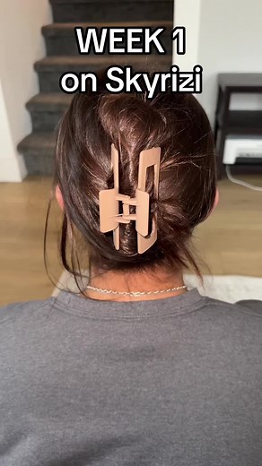 Scalp Psoriasis Journey: First Week Update on Skyrizi