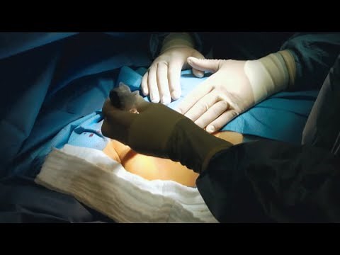 Brustkrebs | Videopodcast Krebsinfotag 2020