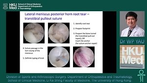 Repairing the Meniscus - How Far Should We Go?