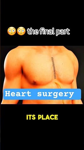 This Is How Doctors Fix Your Heart!