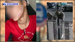 Mom slashed by woman after kid throws up on MTA bus