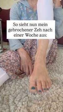Gebrochener Zeh nach 1 Woche! 🫣