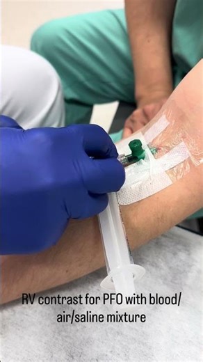 #RV #contrast - how to with #blood #ultrasound #echocardiography