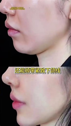 Back training for sagging face one resistance band with four movements to help you