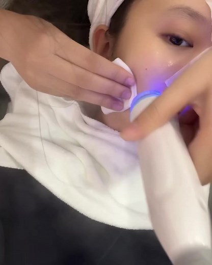 1.8M views · 8.2K reactions | Phục hồi da sau tết ghé ngay Face Wash Fox với công nghệ 퐇퐘퐃퐑퐀 퐅퐀퐂퐈퐀퐋 được các khách hàng “si mê” và review nhiều nhất nhà Cáo ❤️‍ ngập tràn ưu đãi khi đặt lịch ngay hôm nay!力 ️ #FaceWashFox #Caoruamat #dadepbatdautuviecruamat #facialspa #Chamsocda #facewashfoxhochiminh #facewashfoxhanoi | Face Wash Fox | Facebook