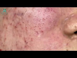 Satisfying Relaxation With Hana Spa #12