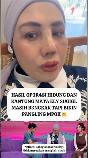Ely Sugigi's nose job results #elysugigi #viralvideo #shortvideo