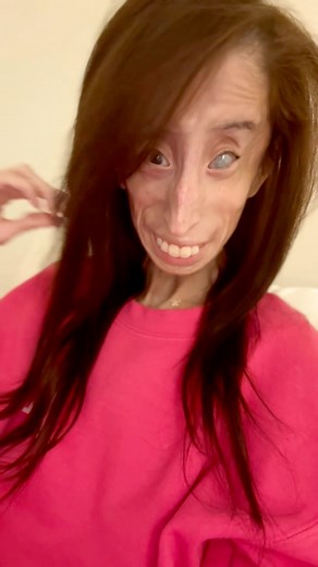 Today I choose to see the glass half full! In full transparency I had a good cry last night feeling overwhelmed with the last couple weeks and thinking about what’s ahead. I’ve learned it’s more than okay to let yourself feel the happy and the sad moments. | Lizzie Velasquez