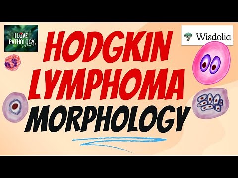 HODGKIN LYMPHOMA | Morphology| Reed-Sternberg Cell- Variants