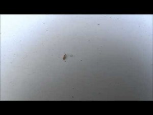 Springtail Tiny Insect antenna garden jumping mite