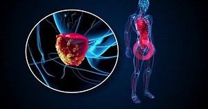 4K abstract 3D animation of the prostate cancer