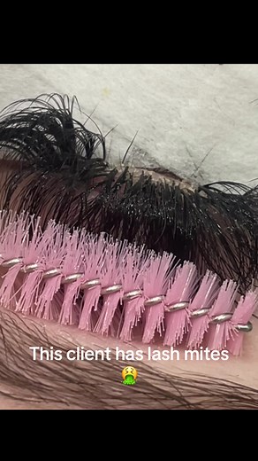 Understanding the Dangers of Lash Mites and Eyelash Extension Care