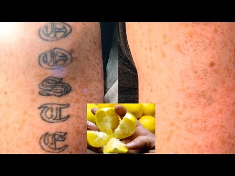 Perfect Ways To Use Salt And Lemon TO Remove Your Permanent Tattoo That are Super Effective
