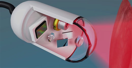 Overcoming language barriers