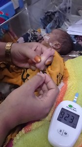 CBC test for new born baby #newborn #nicu | Medical practice