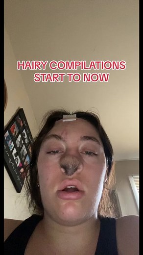 love thisssss 🫶🏼 let’s remember to be nice humans 💛 #hairynose #skintok #skingraft #traumatok #dogattacksurvivor #dogattackawareness #featureme #fyp #tiktok #viral #lmfaooooooooooooooooooooooooooooooooo #traumatized #bignosecheck #original