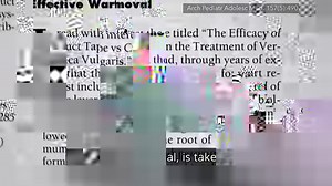 21K views · 216 reactions | Duct tape beat out cryotherapy (freezing)...