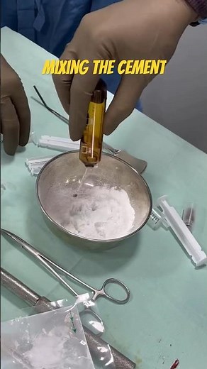 Cementing The Spine 😱😮