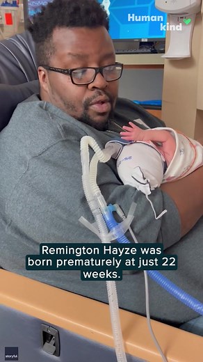 102K views · 5.8K reactions | Less than 25 weeks old and already beating the odds. | Humankind | Facebook