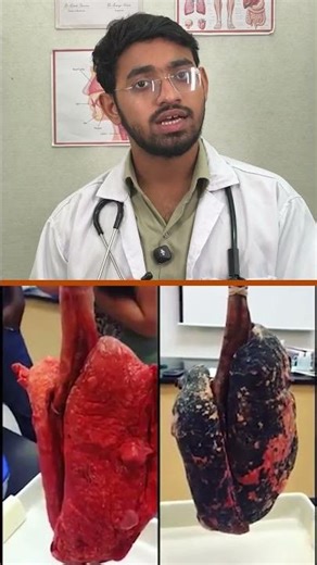 That black lung is a wake-up call