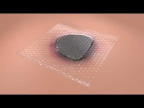 How it works: 3M™ Dermatac™ Drape