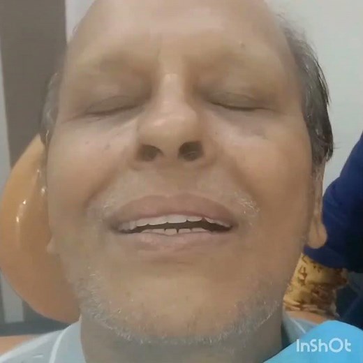 How to fix implant supported overdenture