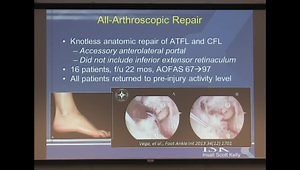 Ankle Sprains and Ligament Reconstruction