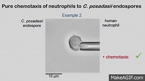 Chemotaxis of human neutrophils to Coccidioides endospores on Make a GIF