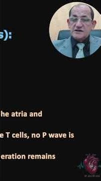 SA EXIT BLOCK ECG DIAGNOSIS (2)