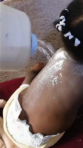 I am using powder to treat my baby from rashey 😍