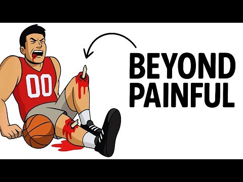 Most Painful NBA Injuries of All Time