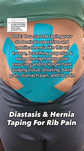 Diastasis + Hernia Self Taping For Rib Pain! #pregnancy #mom #taping #pt #hernia #diastasis #core
