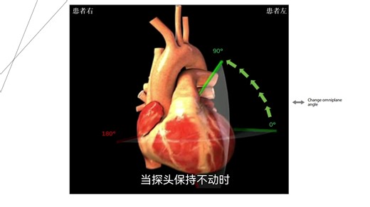 TEE探头操作说明