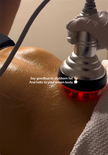 Understanding Ultrasound Cavitation for Body Contouring