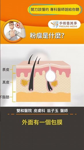 【粉瘤是什麼？】#粉瘤 #皮膚囊腫 #痘痘 #手術善其事 #翁子玉醫師