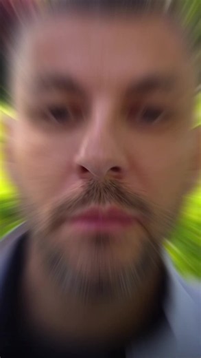 ✨ Da li prvo primetite da vam je lice “palo” ili primećujete sitne nesavršenosti kože? ✨ Zanimljivo je da postoje istraživanja koja pokazuju da mi sami najčešće prvo primećujemo detalje na koži — pore, bore, podočnjake, flekice ili teksturu. Sa druge strane, ljudi koji nas posmatraju mnogo češće prvo primećuju nešto sasvim drugo: ✔️ umoran izraz lica ✔️ spuštenost tkiva ✔️ gubitak svežine ✔️ promenu kontura i volumena Drugim rečima — mi gledamo detalje u ogledalu, a okolina vidi celokupan utisak