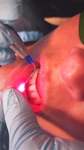 Laci Martoglio, DDS | Cody, Wyoming on Instagram: "We’re addicted and we just can’t get enough 👇🏼💥 Low-level light therapy, also known as low-level laser therapy (LLLT), can offer several potential benefits for your gums before a dental cleaning: 1. Reduced Inflammation: LLLT has been shown to help reduce inflammation and swelling in gum tissues. This can lead to a more comfortable cleaning experience, as inflamed gums can be sensitive during the procedure. 2. Faster Healing: LLLT may stimula