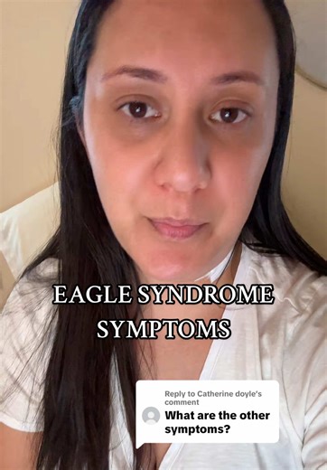 Understanding Eagle Syndrome Symptoms and Their Impact