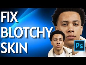 How to Fix Blotchy Skin in Photoshop