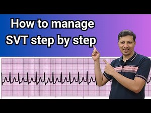How to Manage Supraventricular Tachycardia (SVT) Step by Step |