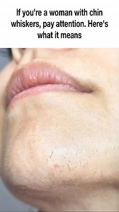 32K views · 106 reactions | Ladies, if you’ve noticed those tiny chin hairs popping up… your body may be trying to tell you something important | Useful Tips | Facebook