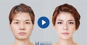 Would you date someone who has had plastic surgery?
