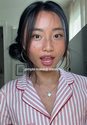 christmas makeup ayeee & this time pimples are not invited✋😌 #acneproneskin #acnejourney #acnemakeup #makeup